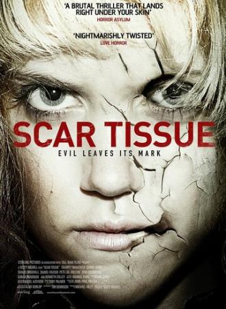 Рубцовая ткань (фильм 2013)