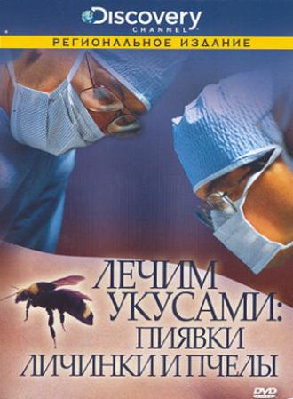 Discovery: Лечим укусами. Пиявки, личинки и пчелы (фильм 2000)