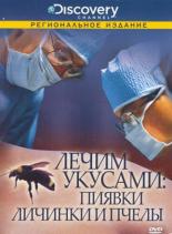 Discovery: Лечим укусами. Пиявки, личинки и пчелы 2000