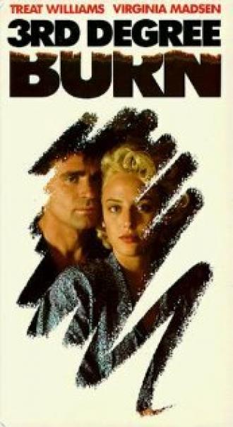 Ожог третьей степени (фильм 1989)