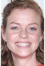 Клер Скэнлон