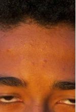 Трэвис Беннетт